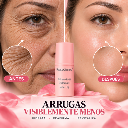 Rosetimes® - PROMOCION 2X1